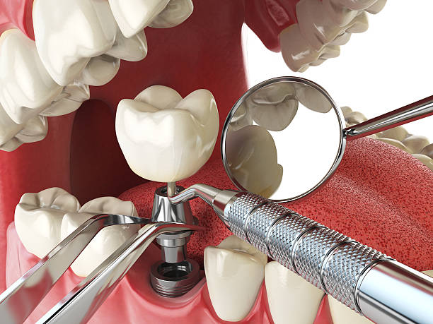 Best 24-Hour Emergency Dental Care in Spring Lake, MI